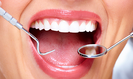 dental-plan-photo dental-plan-photo