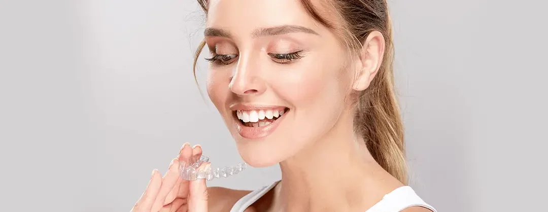 Invisalign Aligners