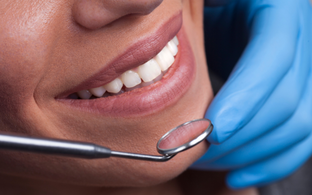 Veneers Near Royal Palm Beach FL