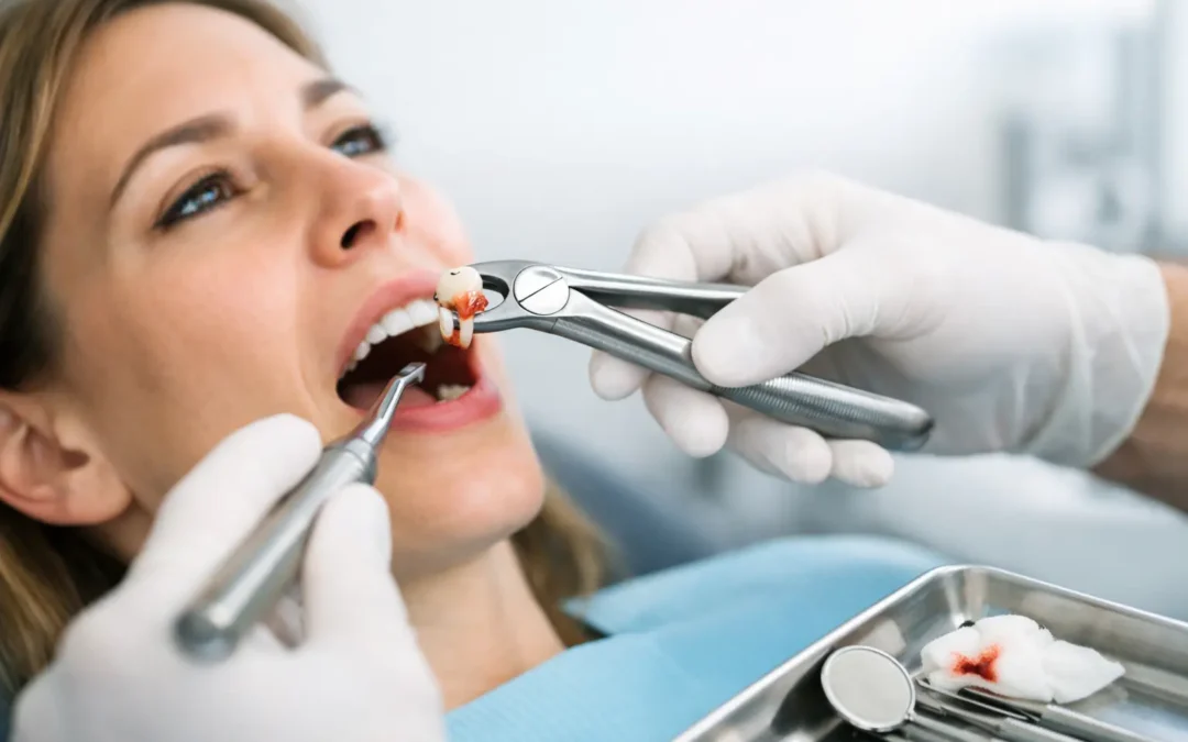 Are Tooth Extractions Painful? What to Expect